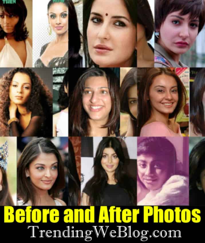 Heroines Plastic Surgery Before And After